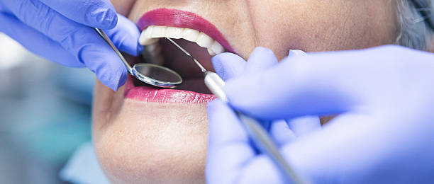 Best Chipped Tooth Repair Near Me  in Palm Harbor, FL